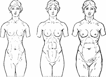 Le lipofilling pour qui ?