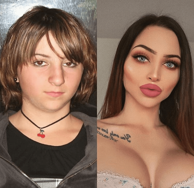 Elle dépense 42 000 euros pour une transformation totale grâce à la chirurgie