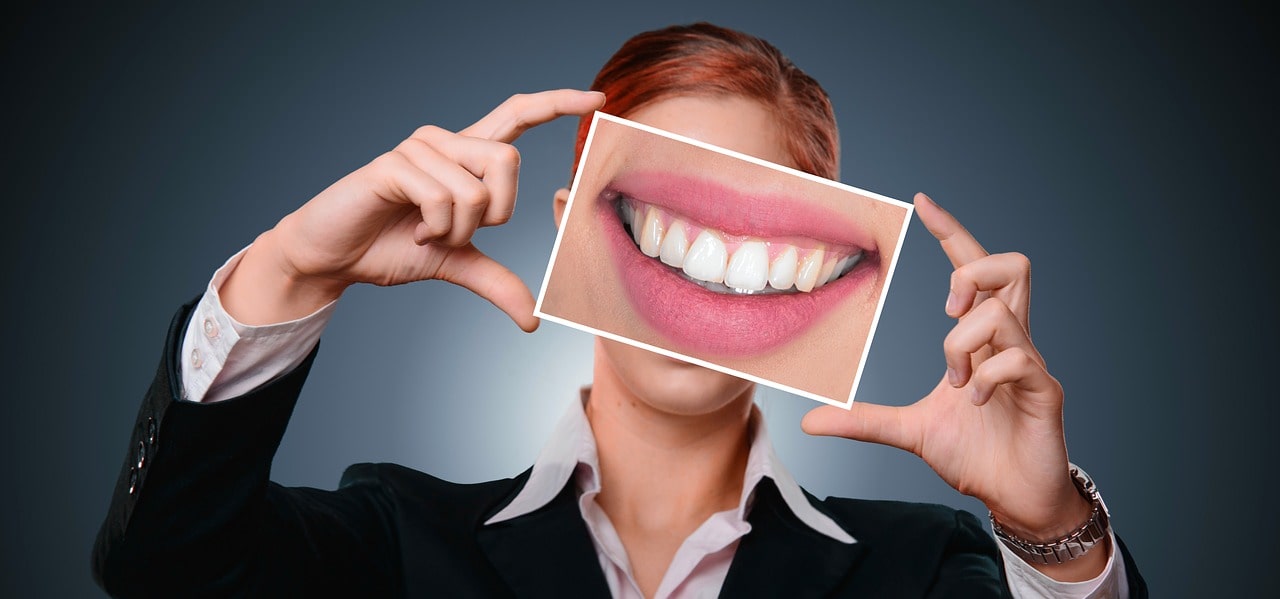 Comment avoir des dents blanches ?