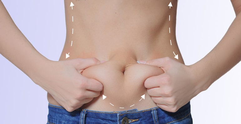 Abdominoplastie