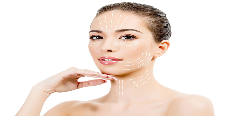 Lifting cervico-facial