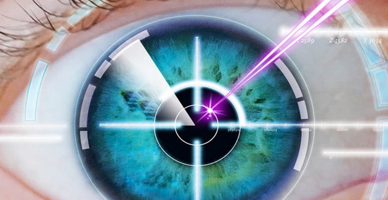 Opération laser des yeux
